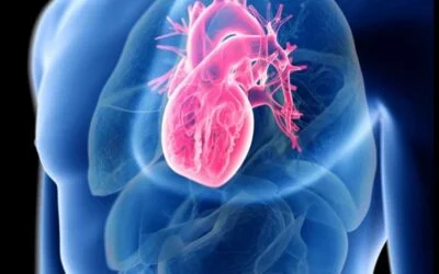 ¿Qué es la Miocarditis?